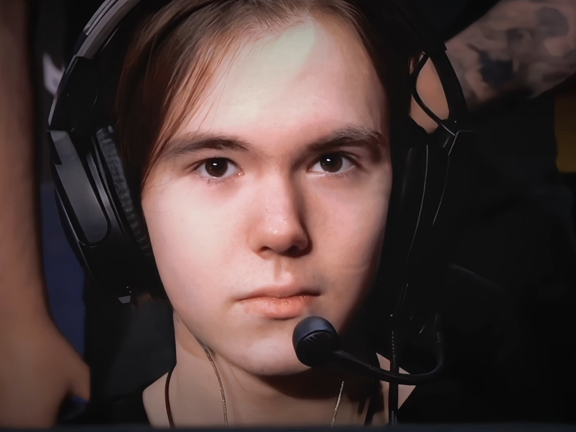 看不清小球 看不清小球